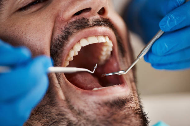Best Mobile Emergency Dentist in Melvindale, MI