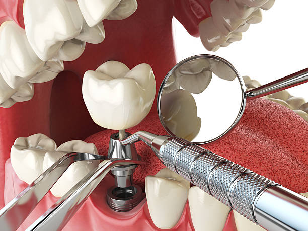 Best Emergency Dental Extractions in Melvindale, MI