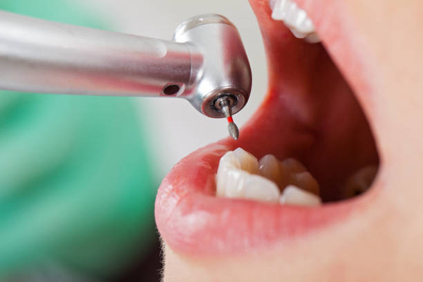 Best Pediatric Emergency Dentist in Melvindale, MI